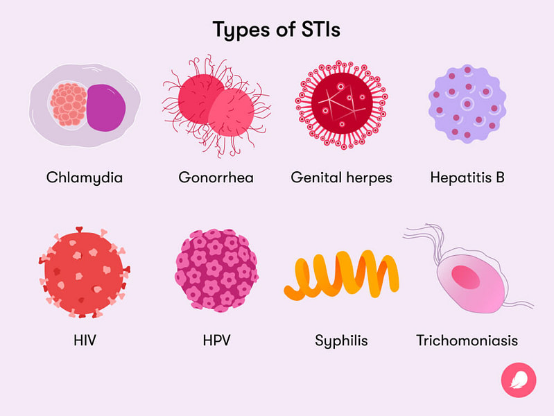 Common types of STIs